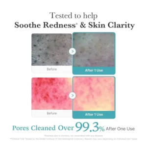 medicube Facial Cleanser Azelaic Acid Whip Cleanser Soothing Cleansing Foam - For Troubled Skin, Ideal for use after spot care, Excess Sebum Control, Korean Skincare, 4.23 oz